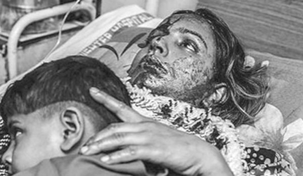 Acid attacks continue to destroy lives acid attacks