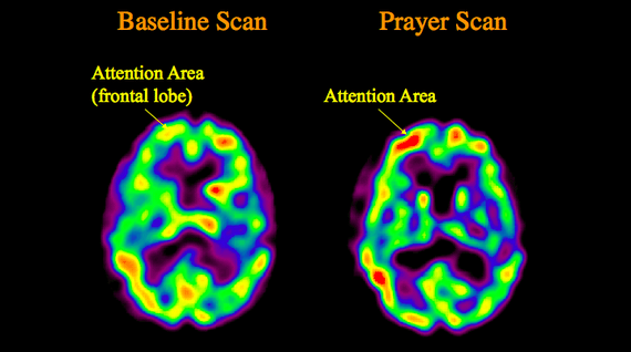 what-happens-in-the-brain-during-a-spiritual-experience