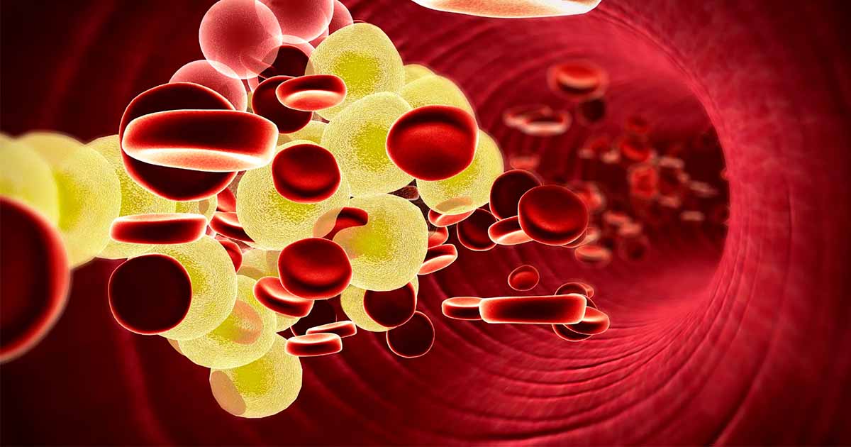 cholesterol