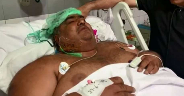 Pakistan’s heaviest man had a successful surgery, then he died heaviest man