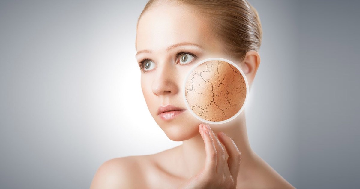 dry skin