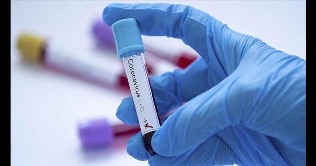 COVID-19 spreading in Pakistan