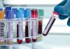 Blood test detect cancer
