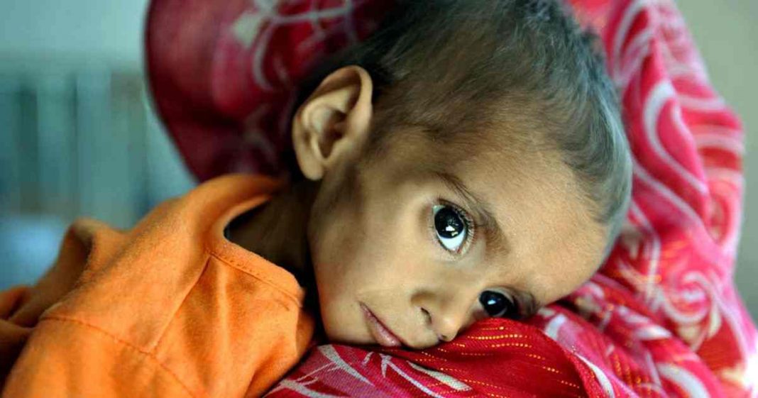 child health inequality