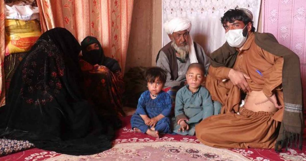 Afghans selling Kidneys