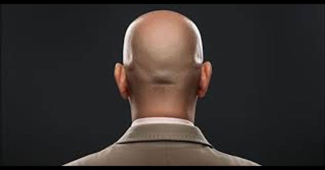 men bald sexual harassment