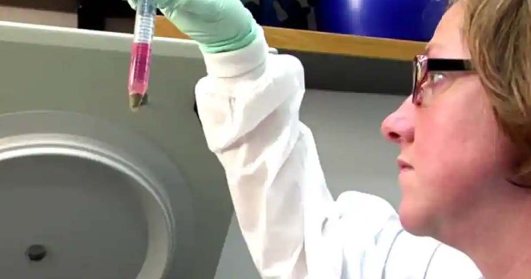 Polio case in New York