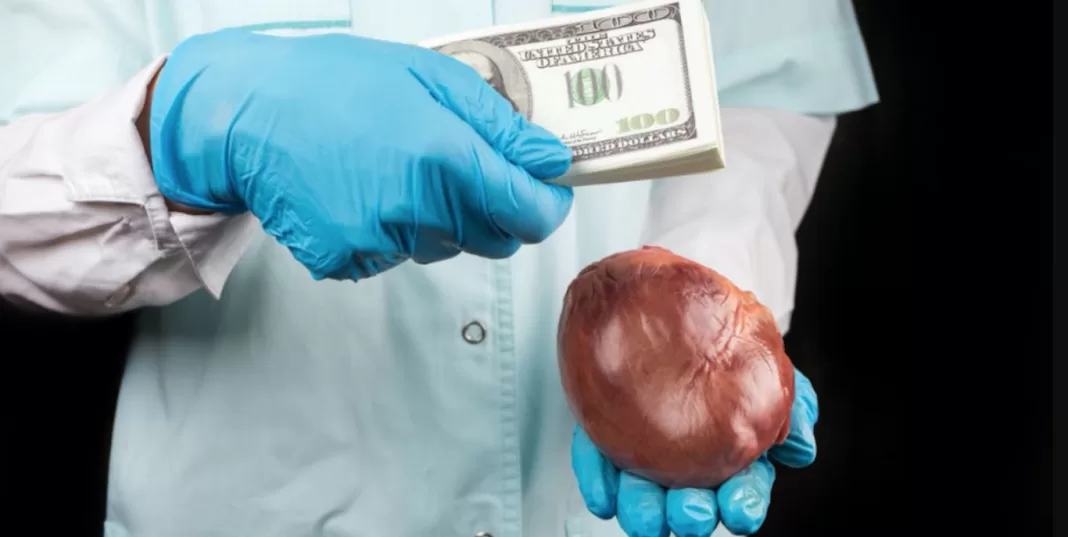 Arrests Made in Underground Kidney Trafficking Ring