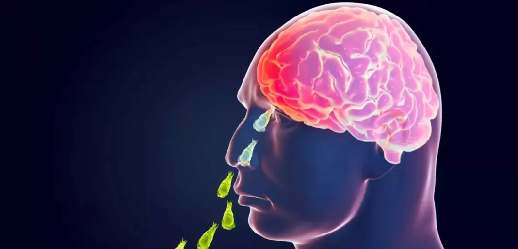 Brain-Eating Amoeba Strikes Lahore: Urgent Public Health Concern